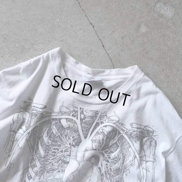 画像2: 1990s ANATOMICAL CHART Co. 人体解剖図スケルトンTシャツ(Tワンピ)　 "MADE IN USA"　 表記XL 